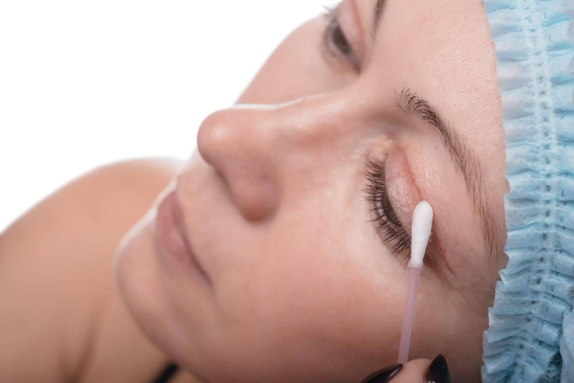 La Clinica de Medicina Estética Elegansse se consolida como uno de los referentes de blefaroplastia mínimamente invasiva de Barcelona
