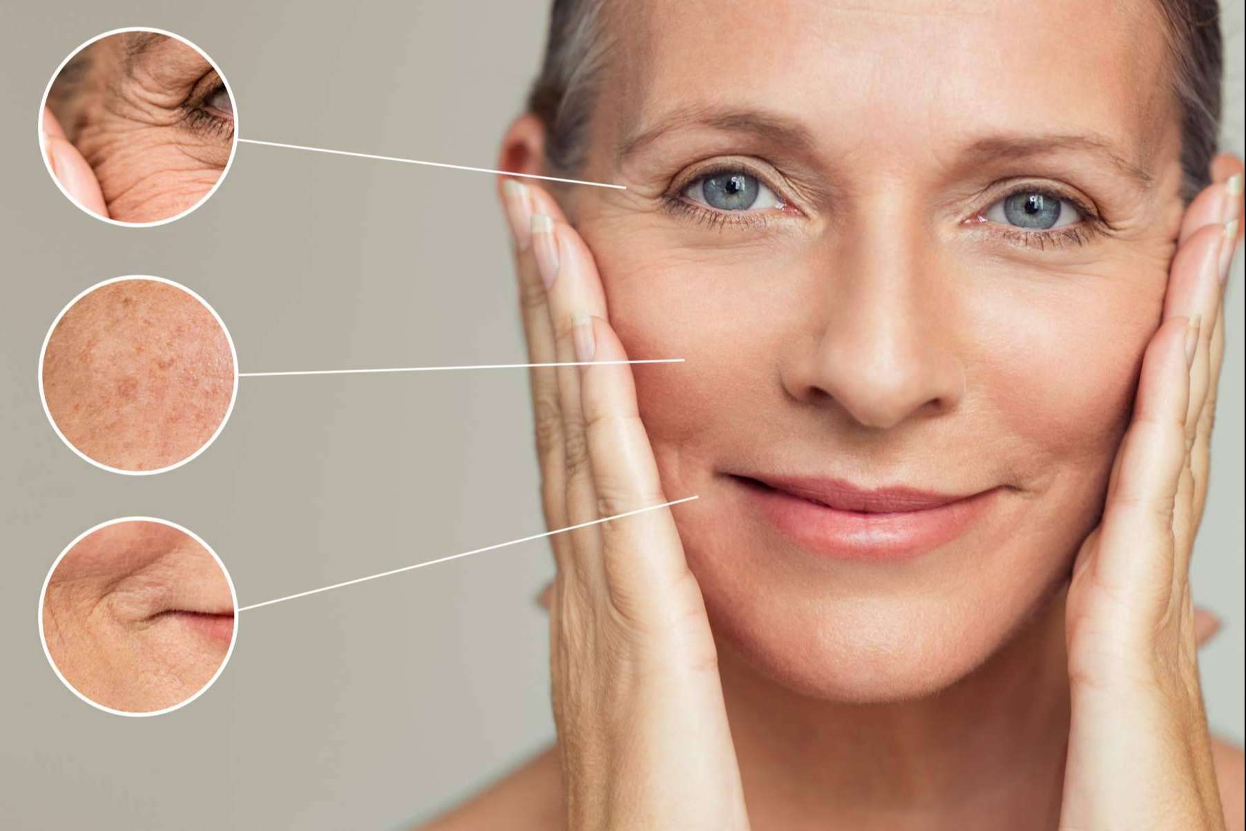 Dermapen, el 'lápiz' que borra arrugas y cicatrices, por 360Clinics