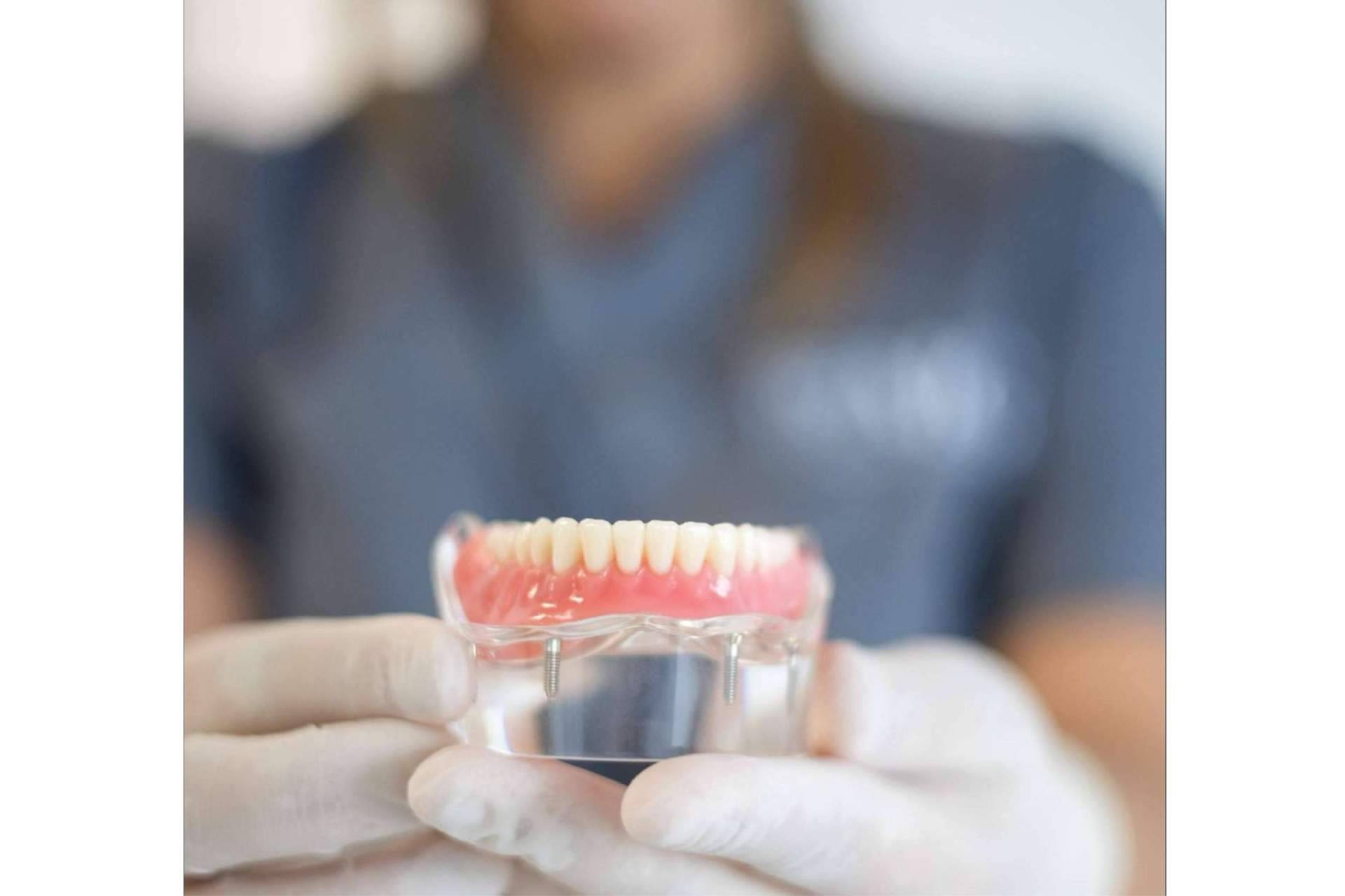 Clínica MG Dental, expertos en implantes dentales