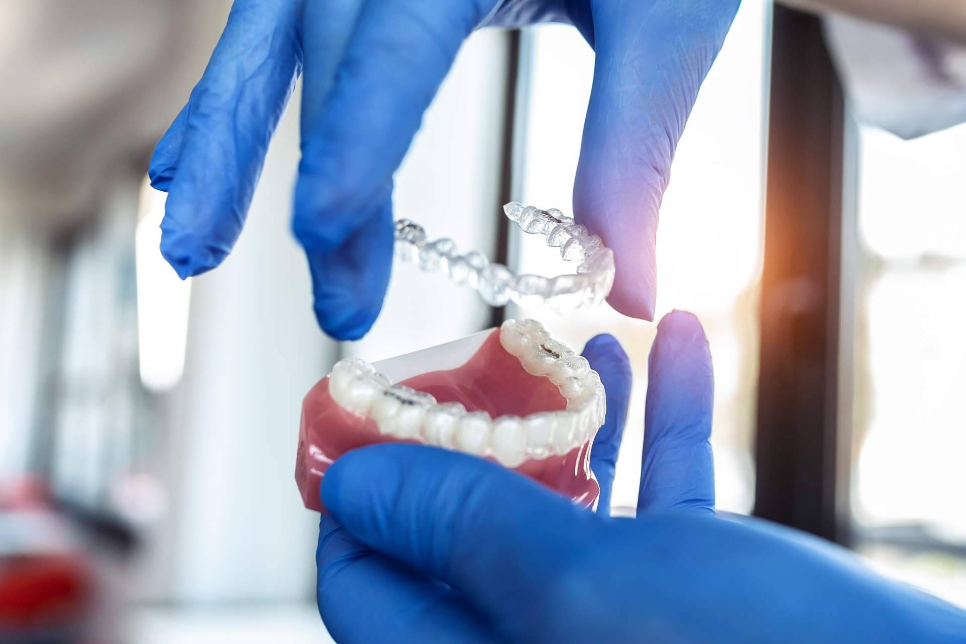 Clínica InterOralia, tratamiento Invisalign a precios competitivos y resultados excepcionales