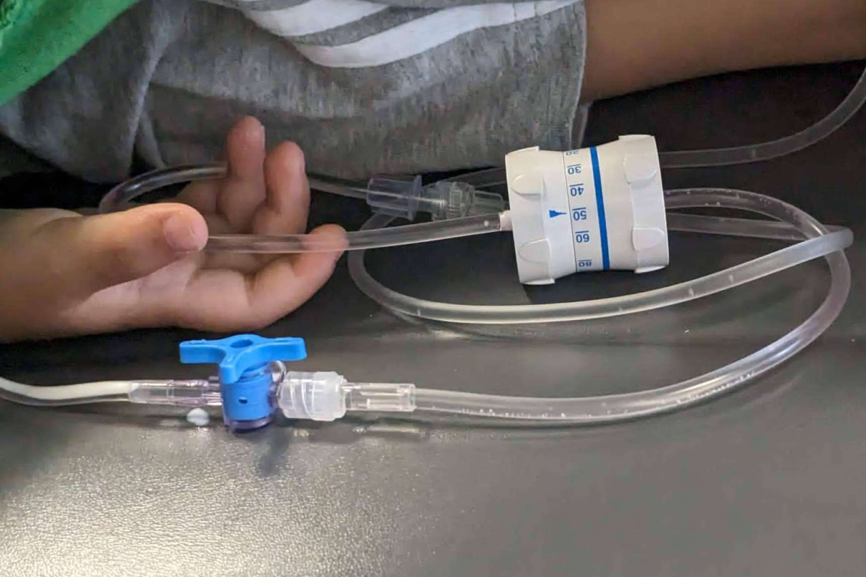 Para una experiencia sin miedo al dentista, Clínica Dental Ulman ofrece sedación consciente