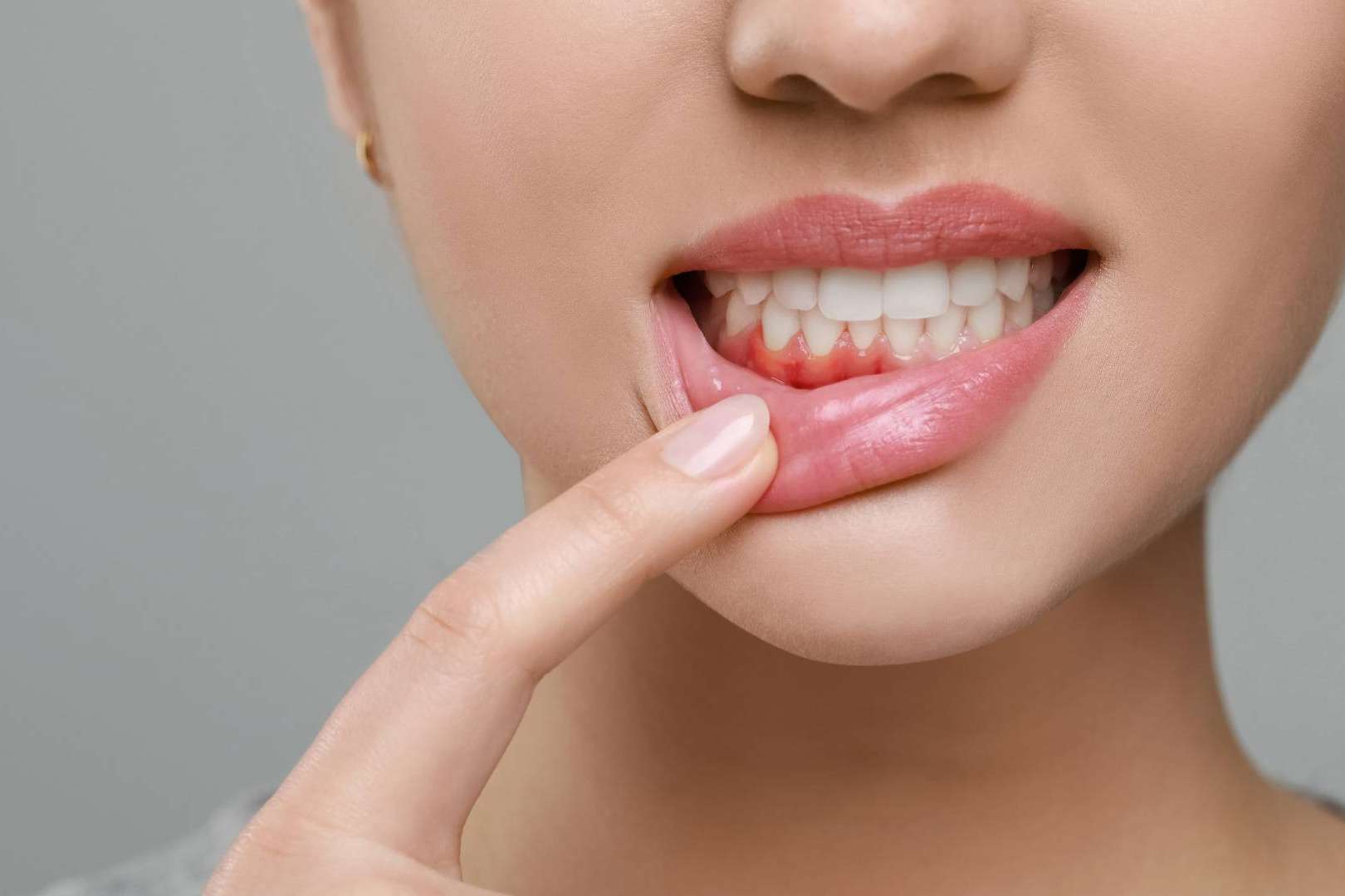 Los implantes dentales, inversión clave para la salud bucodental y estética, con precios que varían según múltiples factores